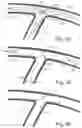 Fig. 09 - Stent system deployment method for bifurcated lesion