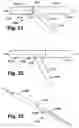 Fig. 10 - Stent system deployment method for bifurcated lesion
