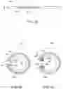 Fig. 08 - Endoluminal sleeve gastroplasty