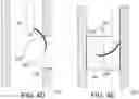 Fig. 11 - Endoluminal sleeve gastroplasty