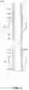 Fig. 14 - Endoluminal sleeve gastroplasty