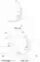 Fig. 15 - Endoluminal sleeve gastroplasty