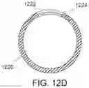 Fig. 27 - Endoluminal sleeve gastroplasty