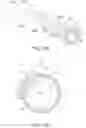 Fig. 28 - Endoluminal sleeve gastroplasty
