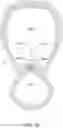 Fig. 33 - Endoluminal sleeve gastroplasty