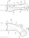 Fig. 05 - NON-WATER-ACTIVATED CAST