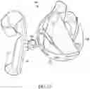 Fig. 13 - Orthopedic shoulder device