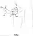 Fig. 03 - MALE URINARY INCONTINENCE DEVICE