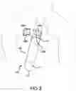 Fig. 04 - MALE URINARY INCONTINENCE DEVICE