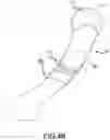 Fig. 06 - MALE URINARY INCONTINENCE DEVICE