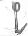 Fig. 08 - Laser thermal conjunctivoplasty