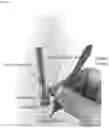 Fig. 09 - Laser thermal conjunctivoplasty