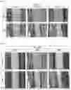 Fig. 16 - Laser thermal conjunctivoplasty