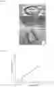 Fig. 20 - Laser thermal conjunctivoplasty