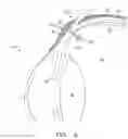 Fig. 04 - Diagnostic methods and apparatus