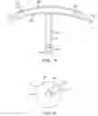 Fig. 33 - Diagnostic methods and apparatus