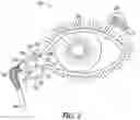 Fig. 03 - Lacrimal implants and related methods
