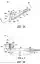 Fig. 04 - Lacrimal implants and related methods