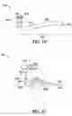 Fig. 14 - Lacrimal implants and related methods