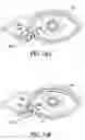 Fig. 23 - Lacrimal implants and related methods
