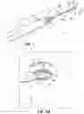 Fig. 02 - Instrument for treating an ocular disorder