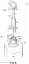 Fig. 03 - Instrument for treating an ocular disorder