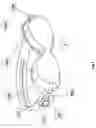 Fig. 02 - Glaucoma treatment eyeglass with visual stimulation