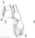 Fig. 03 - Glaucoma treatment eyeglass with visual stimulation