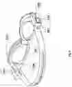 Fig. 06 - Glaucoma treatment eyeglass with visual stimulation