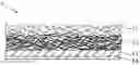 Fig. 01 - LOOP MEMBER AND DIAPER
