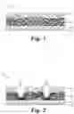Fig. 02 - LOOP MEMBER AND DIAPER