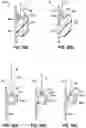 Fig. 23 - Patient repositioning system