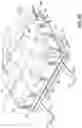 Fig. 26 - Patient repositioning system