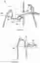 Fig. 16 - Upper-body robotic exoskeleton