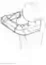 Fig. 08 - CABLE OPERATED MOTION AUGMENTATION SYSTEM AND METHOD