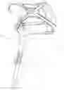 Fig. 12 - CABLE OPERATED MOTION AUGMENTATION SYSTEM AND METHOD