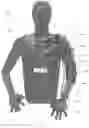 Fig. 17 - CABLE OPERATED MOTION AUGMENTATION SYSTEM AND METHOD