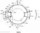 Fig. 09 - Enteral fluid delivery system