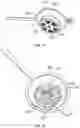 Fig. 16 - Enteral fluid delivery system