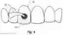 Fig. 05 - Stable dental varnish compositions and methods of manufacture and use