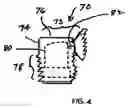 Fig. 05 - Teeth Whitening Kit