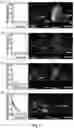 Fig. 21 - Biopatch, bioheater, biosensor and bioelectronic patch device