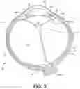 Fig. 03 - Shape changing drug delivery devices and methods