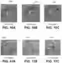 Fig. 10 - Shape changing drug delivery devices and methods