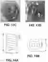 Fig. 13 - Shape changing drug delivery devices and methods
