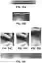 Fig. 14 - Shape changing drug delivery devices and methods