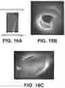 Fig. 15 - Shape changing drug delivery devices and methods