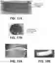 Fig. 16 - Shape changing drug delivery devices and methods