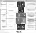 Fig. 20 - Shape changing drug delivery devices and methods
