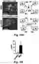 Fig. 32 - Stem cell biomimetic microparticles